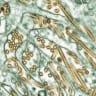 How many human H5N1 cases will be reported in the United States in 2026?