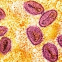 How many mpox clade Ib cases will be reported in the United States in 2026?
