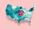 Cyclosporiasis cases in U.S. by July 31?